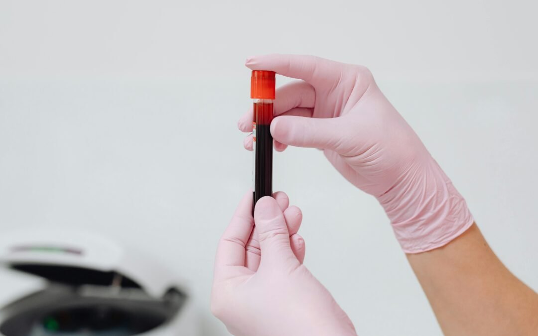 Why a hormone test alone won’t help clear hormonal acne