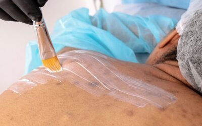 Why Do I Get Acne on My Back? 5 Possible Causes of Bacne